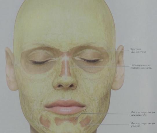 That's how subcutaneous fat is distributed in our face (yellow). In the circular muscles of the eyes layer of connective tissue contains almost no fat
