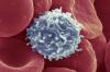 Scientists have found a way, causing the T cells to begin to fight cancer