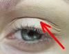How to get rid of drooping eyelids without plastics