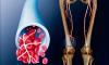 Diet and nutrition deep vein thrombosis of the lower limbs