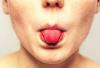 Cancer of the tongue: the warning signs