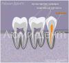 How to find and treat dental canals in Lumident