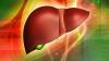 10 basic rules of healthy liver