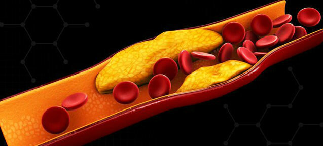Cholesterol - cholesterin