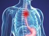 Esophageal cancer: the first signs of which can not be ignored