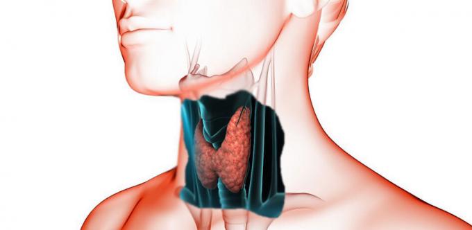 In the case of disorders of the thyroid gland, contact your doctor. He will diagnose (blood tests, palpation, ultrasound) and will be able to appoint a constructive treatment.