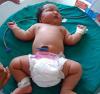 6 to 8 kg: the largest newborns in the world