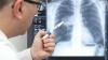 Physician Compares Radiation Exposure With CT Of Lungs With Radiation In Hiroshima