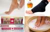 How to get rid of foot rough skin and prevent it from happening