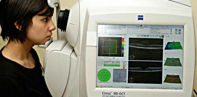 Optical coherence tomography angiography