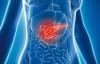 The symptoms of pancreatic cancer