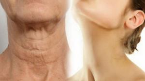 How to get rid of the sagging skin on the neck