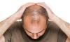 Which cells are responsible for the graying of hair and hair loss