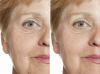 How to remove wrinkles without injections: 5 simple exercises