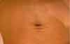 Exercise "Ring": Get rid of sagging skin on the stomach and reduce the waist to 15 cm. Paying 2 minutes per day