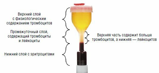 This is how should look like a test tube for PRP-therapy. Source: Medical scientific and practical portal "attending physician"
