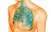 Lung disease that creeps up unnoticed