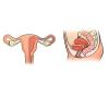 What happens to the uterus before and after childbirth: what needs survey