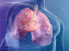 The tumor in the lung: 5 Signs