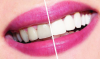 How to whiten your teeth at home? dental advice.