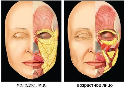 Changing the fat folds on the face with age