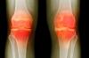 How to prevent age-related wear and tear of the joints