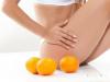 Cellulite: Truths and Myths
