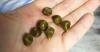 How to avoid the formation of gallstones