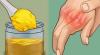 How to get rid of pain in the joints of hands