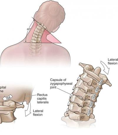 4 basic exercises for the cervical spine will help you forget about pain and osteochondrosis!