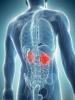 Kidney cancer: early symptoms that should alert