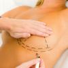 Breast Lift: how real are the risks?